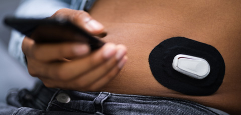 Dexcom Glucose Monitor On A Person