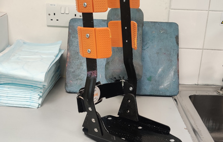 Charcot Foot Personal Story Andy Austin Pt2 Pic 6 (1)