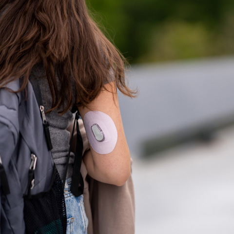 CGM Dexcom On An Arm