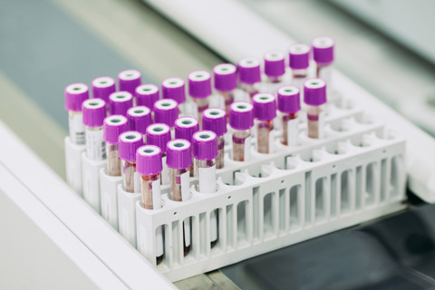 Blood Test Tubes