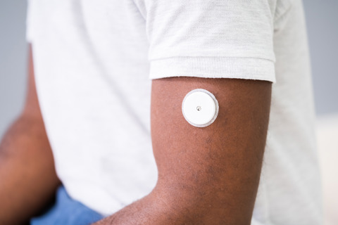 CGM On Arm